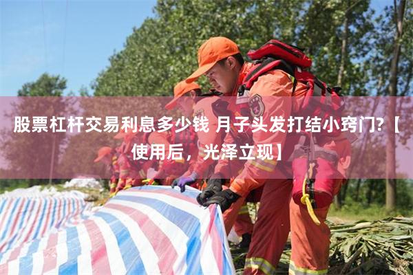 股票杠杆交易利息多少钱 月子头发打结小窍门?【使用后，光泽立